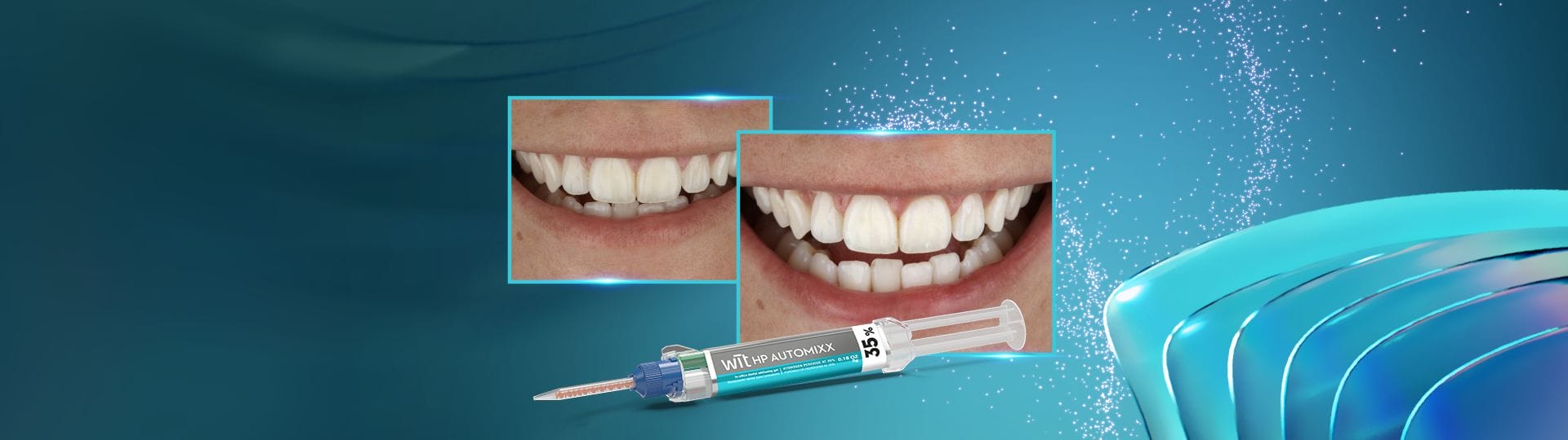 Tooth whitening in the office: a fast and effective alternative for immediate whitening